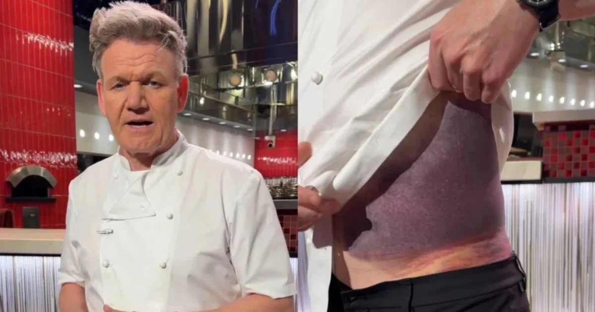 gordon ramsay bike accident